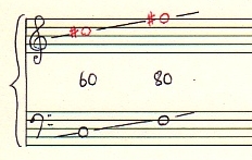 歯車比17:xの車両